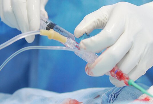 What are the angiography fees in Yashoda Hospitals What are the angiography fees in Yashoda Hospitals