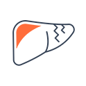 liver transplant in hyderabad
