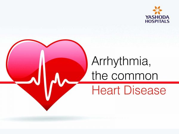 signs of heart arrhythmia