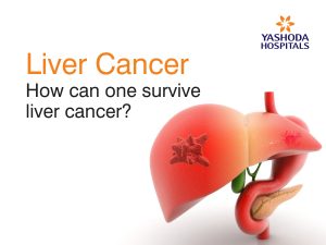 survive liver cancer