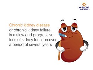 Chronic Kidney Disease (CKD): Causes, Symptoms, Diagnosis and Treatment