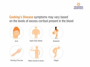 Living with Cushing’s Disease