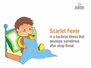 Scarlet Fever is a childhood illness caused by a bacterial infection