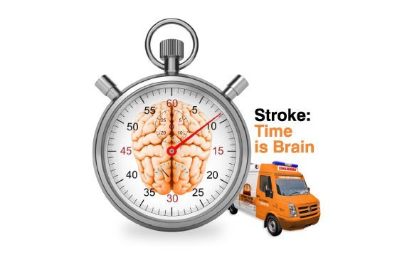 STROKE Think FAST Act FAST