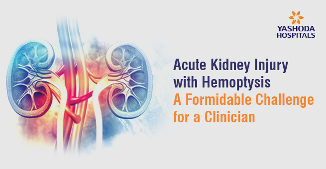 Acute Kidney Injury with Hemoptysis