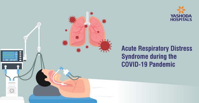 Acute Respiratory Distress Syndrome during the COVID-19 Pandemic