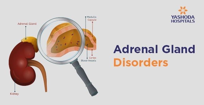 signs of adrenal gland problems