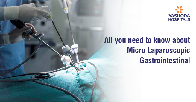 All you need to know about Micro Laparoscopic Gastrointestinal