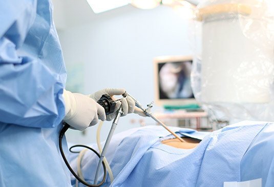 Benefits of endoscopic spine surgery