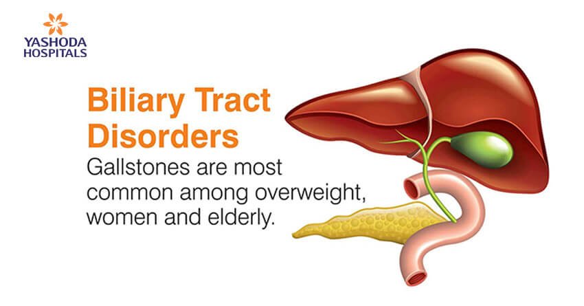 Biliary Disorders: Symptoms, Causes, Treatment and Risk Factors of ...