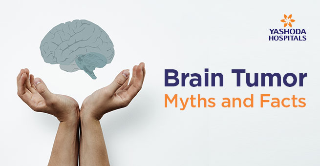 Brain Tumor Myths and Facts