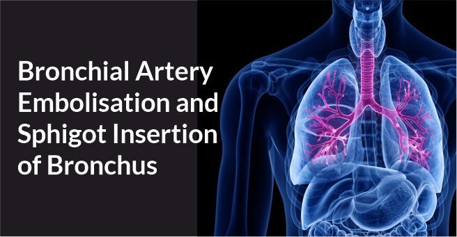 bronchial and pulmonary artery