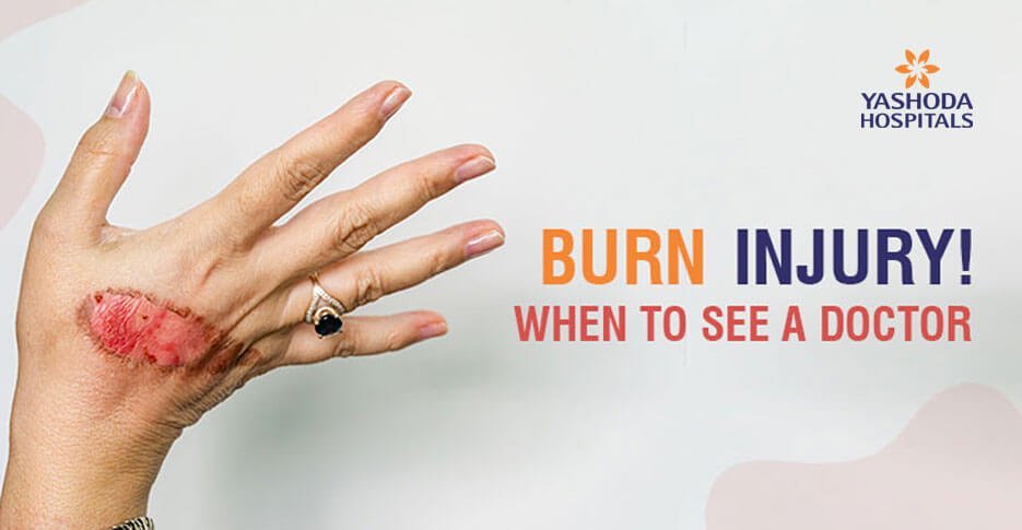 Burn injury: When to seek emergency medical care