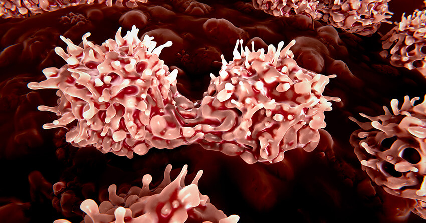 Cancer Haplo-identical Stem Cell Transplants