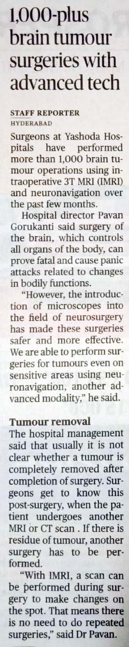 Complex Brain Surgery Successfully Performed 1
