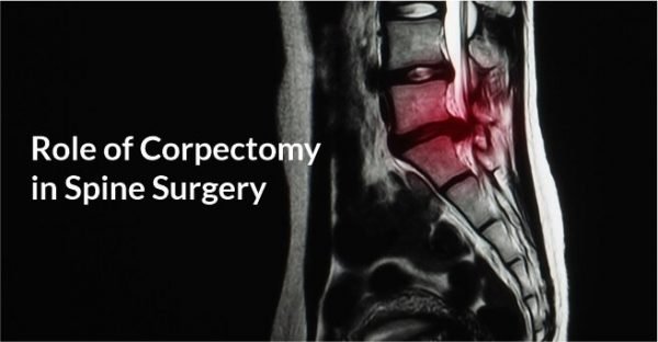 Role of Corpectomy in Spine Surgery