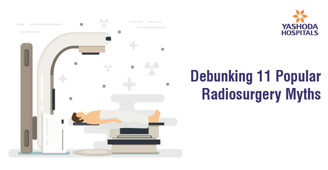 Debunking 11 Popular Radiosurgery Myths