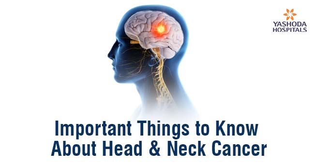 Diagnosis and Treatment for Head and Neck cancers