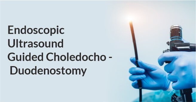 Endoscopic Ultrasound Guided Choledocho -Duodenostomy
