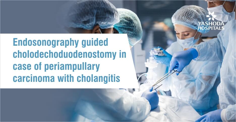 Endosonography guided cholodechoduodenostomy in case of periampullary carcinoma with cholangitis