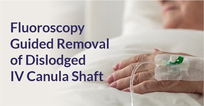 Fluoroscopy Guided Removal of Dislodged IV Canula Shaft