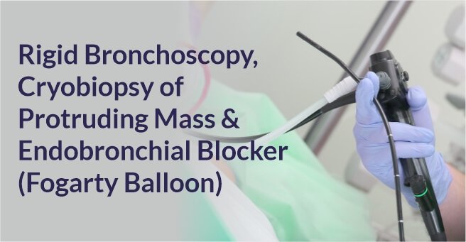 Rigid Bronchoscopy