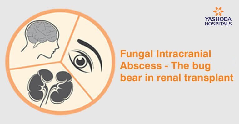 Fungal-Intracranial-Abscess