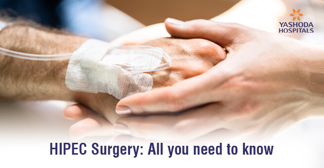 HIPEC Surgery: All you need to know