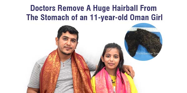 Remove A Huge Hairball From The Stomach