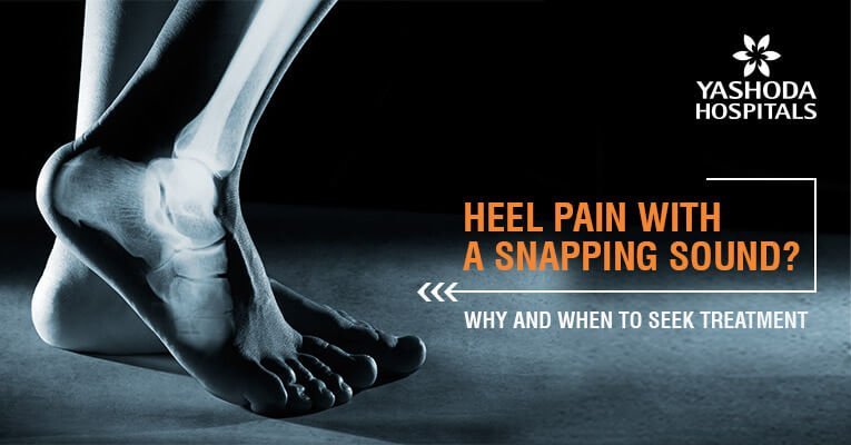 Heel pain with a snapping sound