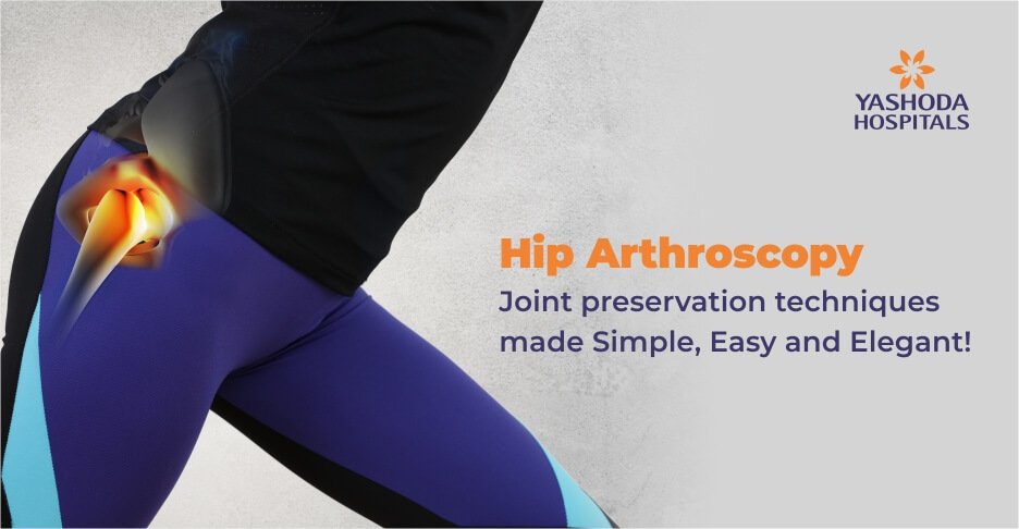 Hip Arthroscopy: Joint preservation techniques made Simple, Easy and Elegant