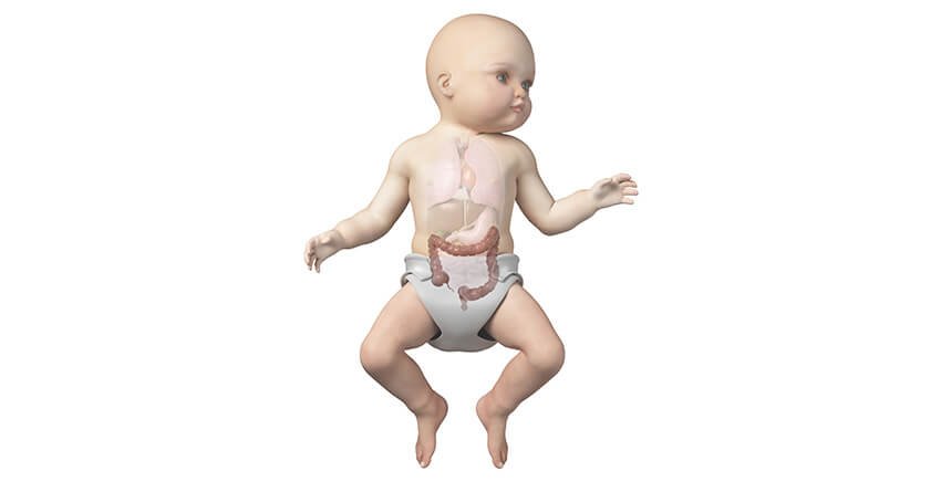Hirschsprung’s Disease-babies or children