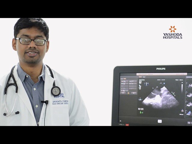 Hole in heart (Atrial Septal Defect) closed without doing open-heart surgery Dr. Pramod Kumar K