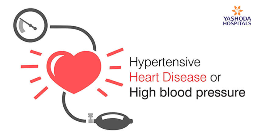 Hypertensive Heart Disease or High blood pressure