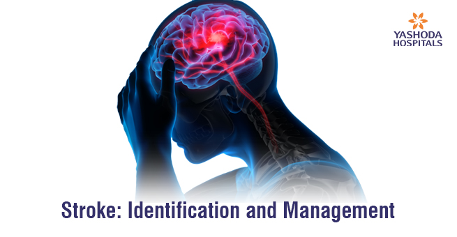 Stroke identification and management