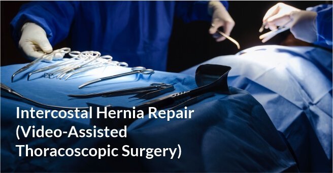Intercostal Hernia Repair (Video-Assisted Thoracoscopic Surgery)