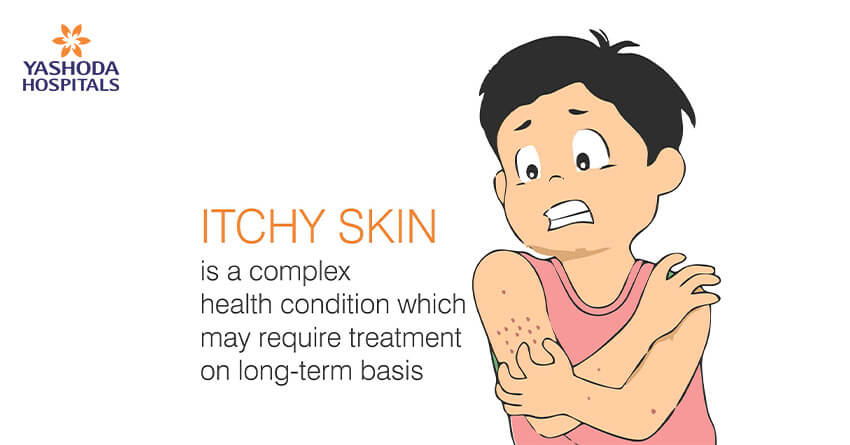 Itchy skin-complex health condition
