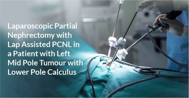 Laparoscopic Partial Nephrectomy with Lap Assisted PCNL