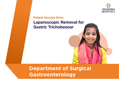 Laparoscopic Removal for Gastric Trichobezoar