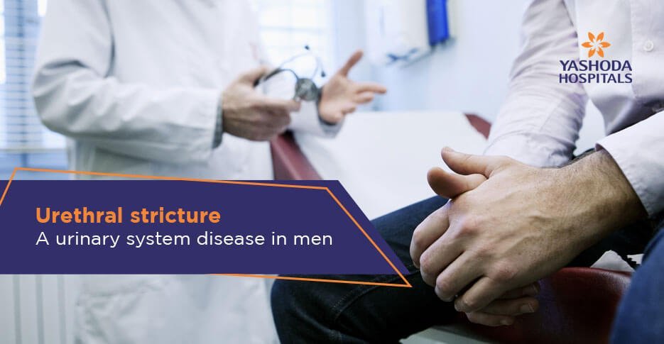 Male urethral stricture the disease is as old as humanity