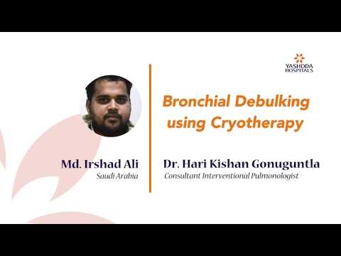Patient Testimonial for bronchoscopic debulking by Md. Irshad Ali from Saudi Arabia