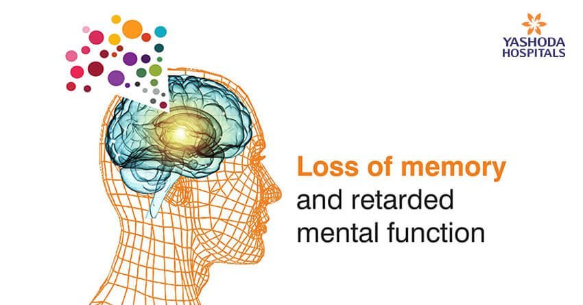 Alzheimer’s is a condition marked by loss of memory and retarded mental function