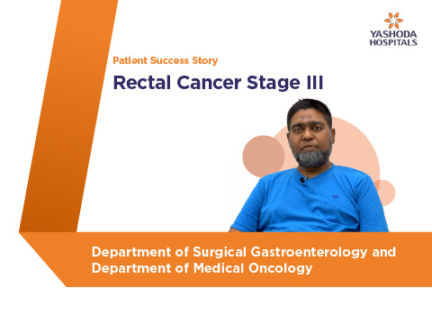 Rectal Cancer Stage 3