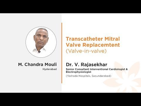 Mr. Chandra Mouli Transcatheter Mitral Valve Replacement