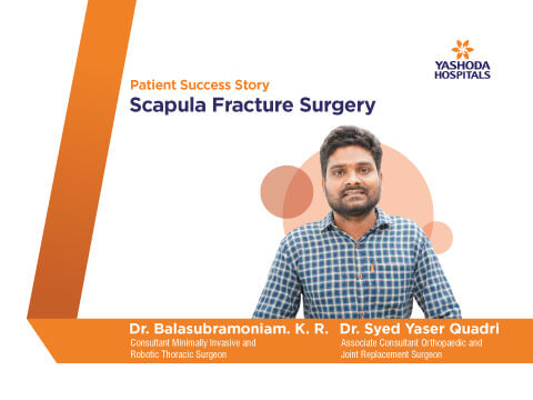 Scapula Fracture Surgery by Dr. Syed Yaser Quadri