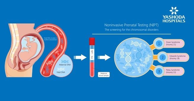 Prenatal Tests