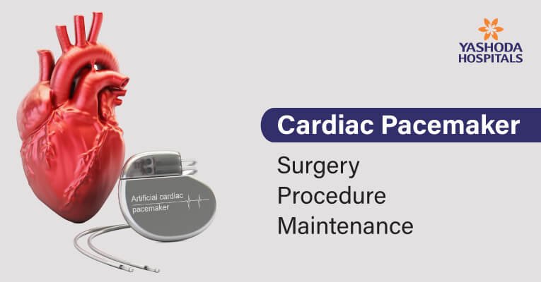 Pacemaker-surgery- procedure