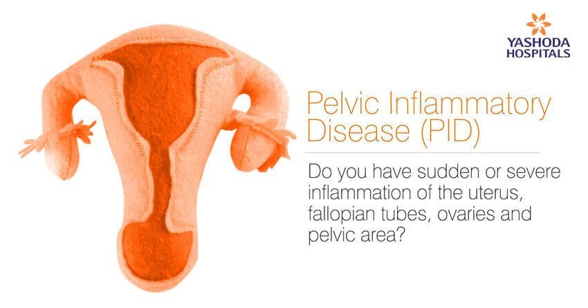 pelvic inflammatory disease