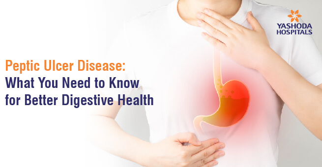 Peptic Ulcer Disease: What You Need to Know for Better Digestive Health