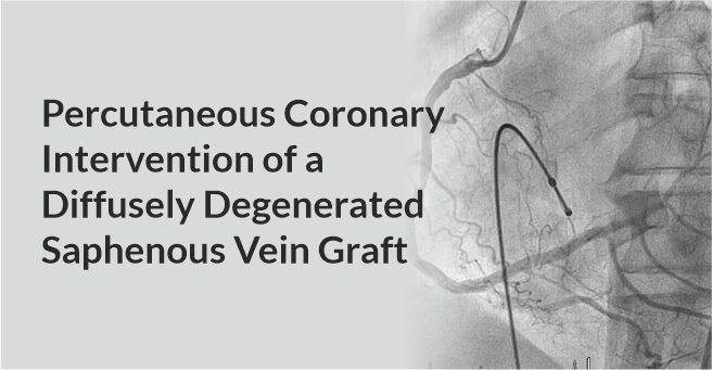 Download Percutaneous Coronary Intervention Of A Diffusely Degenerated Saphenous Vein Graft A Road Less Taken